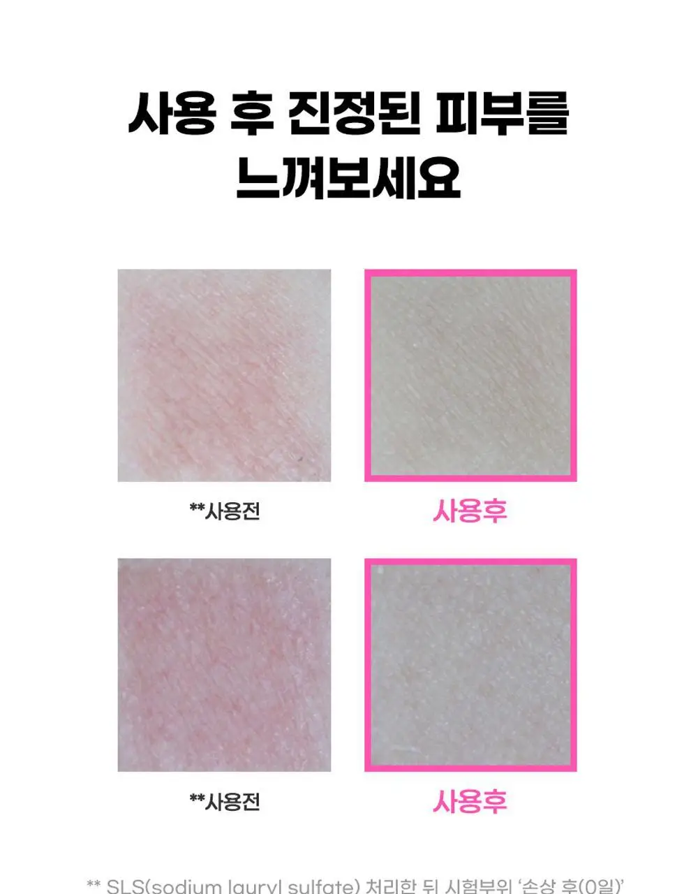 [재구매1위] 앰플엔 세라마이드샷 화잘먹 보습장벽앰플 100ml기획(+10ml) 상세페이지 31